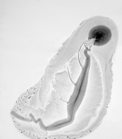 Radiolarians Series: Untitled #10, 2011